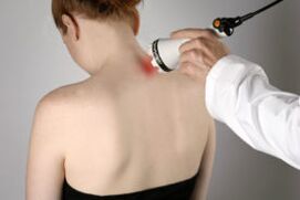 Traitement de l'ostéochondrose cervicale avec traitement au laser