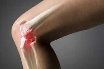 L'arthrose de l'articulation du genou est une lésion du tissu du cartilage