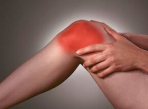 Le symptôme de l'arthrose est une douleur intense dans la zone du genou