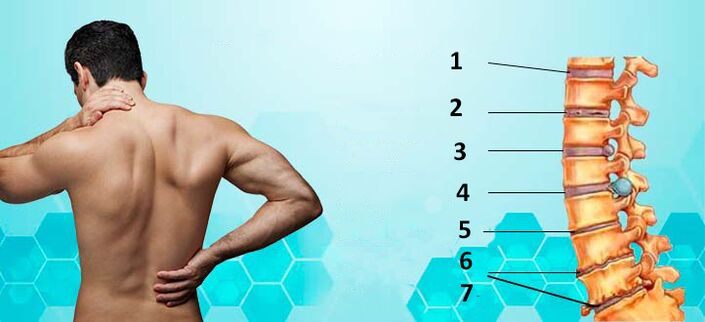 Stades de développement de l'ostéochondrose